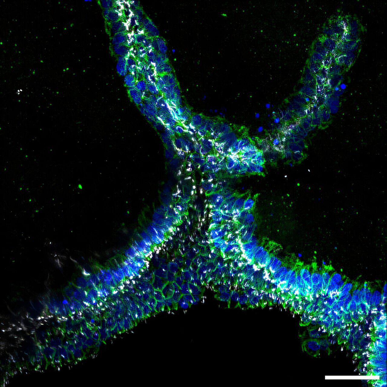 Bioengineers build branched, perfusable kidney collecting ducts using 3D bioprinting